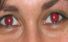 Yeux rouges